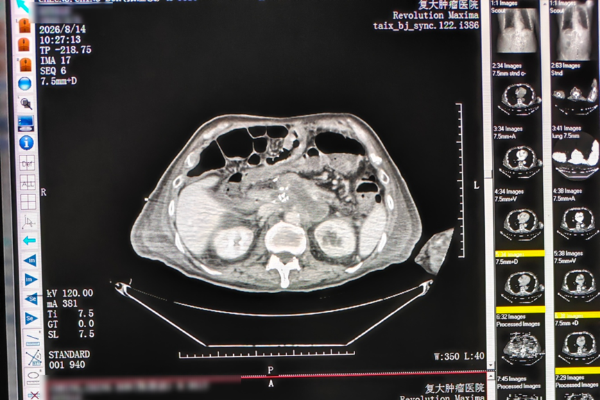 ny20_772711.png image.png